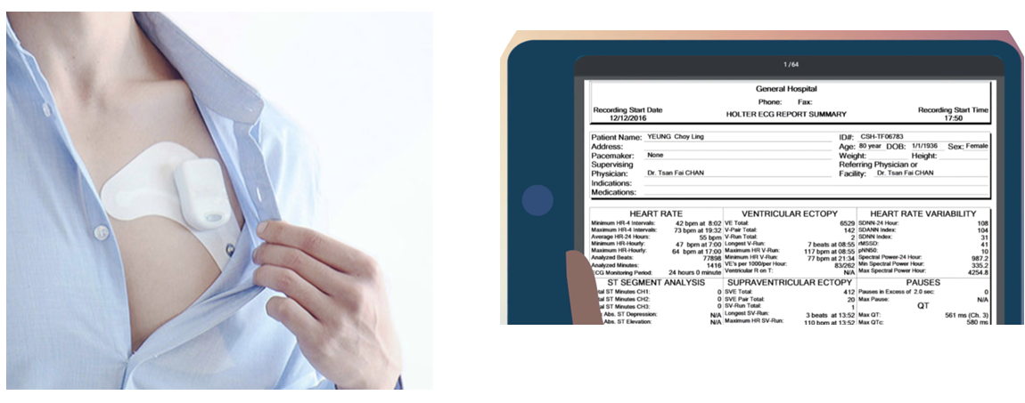 Cardiac Monitor Platform