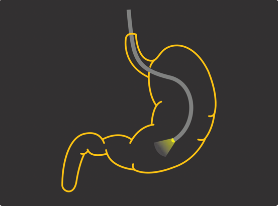 Gastroenterology 2